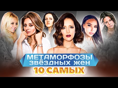 Видео: Жены звезд до и после пластики | Самойлова, Ревва, Галустян, Шнурова, Брухунова