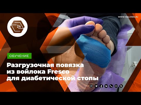 Видео: Разгрузочная повязка из войлока Fresco для диабетической стопы