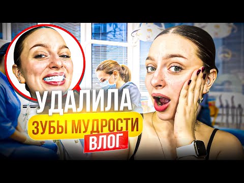 Видео: УДАЛИЛА ЗУБЫ МУДРОСТИ vlog