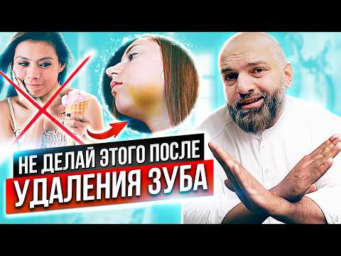 Видео: Рекомендации после удаления зуба. Что можно и что нельзя делать, когда удалили зуб?