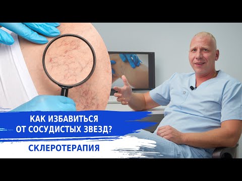 Видео: КАК УБРАТЬ СОСУДИСТУЮ СЕТКУ НА НОГАХ?