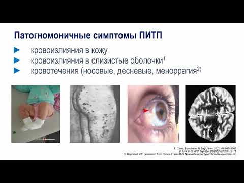 Видео: Лекция № 4 Геморрагические болезни у детей