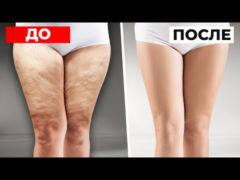 Видео: КАК УБРАТЬ ЛЯЖКИ? Всего 3 упражнения на внутреннюю часть бедра в любом возрасте