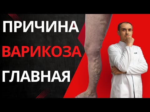 Видео: Почему венозные клапаны не работают. Флеболог Москва