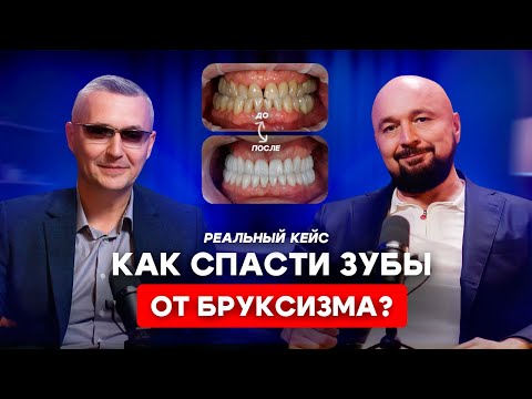 Видео: Сложные случаи из нашей практики  Лечение неправильного прикуса и стираемости зубов