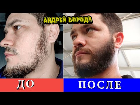 Видео: Сделал бороду ГУЩЕ за 100 дней / Это помогло мне увеличить плотность бороды/ВЫПУСК №3/ Андрей Борода