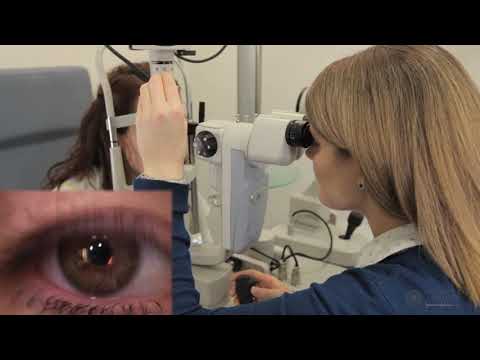 Видео: Методы щелевой лампы: зеркальное отражение