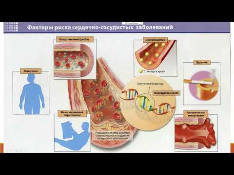 Видео: Атеросклероз  Лекция для студентов Проф  И В  Козлова
