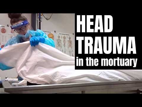 Видео: Травма головы в морге