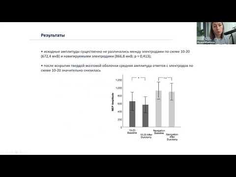 Видео: Новое в Интраопрационном нейромониторинге (ИОМ). Журнальный клуб Асклин.