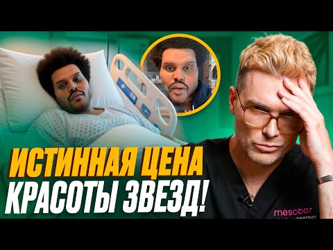 Видео: ВОТ что сделали с собой ЗВЕЗДЫ Голливуда: The Weeknd, Kanye West, Сильвестр Сталлоне, Зак Эфрон