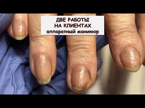 Видео: #193 ДВЕ РАБОТЫ НА КЛИЕНТАХ аппаратный маникюр
