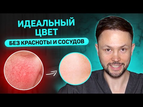 Видео: Как избавиться от покраснений и сосудов на лице? Лучшие советы и процедуры от дерматолога