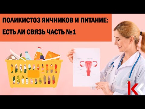 Видео: Поликистоз яичников и питание: есть ли связь? Часть 1.