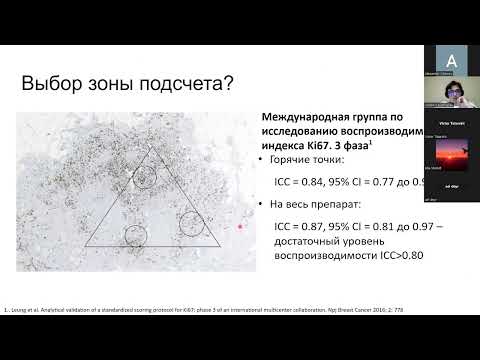 Видео: Владимир Кушнарев: "Значение экспрессии белка Ki67 в диагностике солидных карцином"