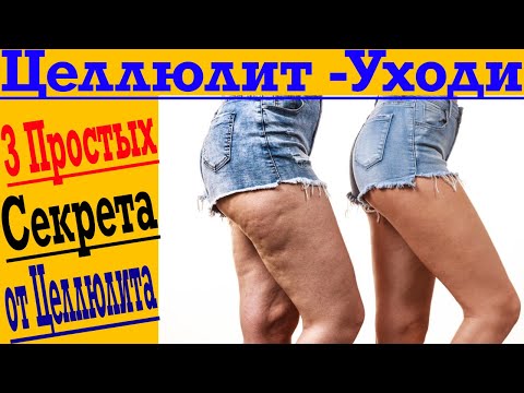 Видео: Как избавиться от целлюлита навсегда! Три простые секрета красоты!