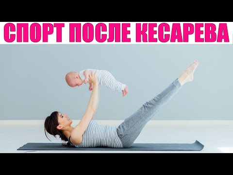 Видео: СПОРТ ПОСЛЕ КЕСАРЕВА СЕЧЕНИЯ | Когда можно начинать заниматься спортом после кесарева сечения