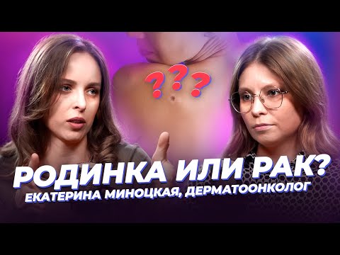 Видео: Родинка или рак: как отличить 🎙 Екатерина Миноцкая, дерматоонколог