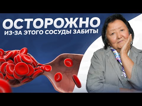 Видео: Симптомы забитых сосудов