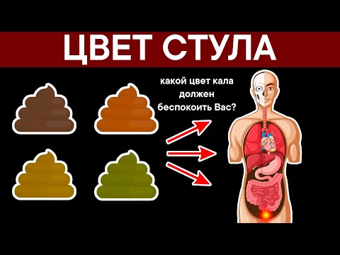 Видео: ЦВЕТ СТУЛА. Какой Цвет Кала должен беспокоить Вас?