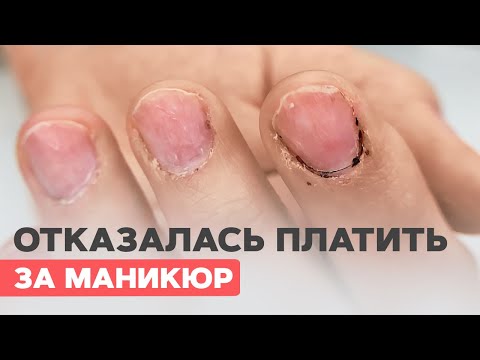 Видео: Испортили ногти в салоне | Что делать? Наращивание или нет?