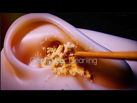 Видео: ASMR ★Soft tingle★ Чистка ушей для глубокого сна🌙😴 Удаление большого количества ушной серы!!