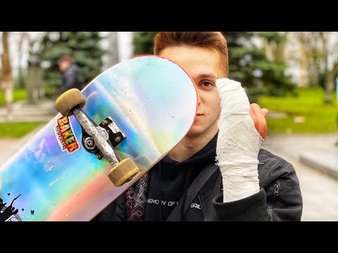 Видео: Я СЛОМАЛ ПАЛЕЦ!