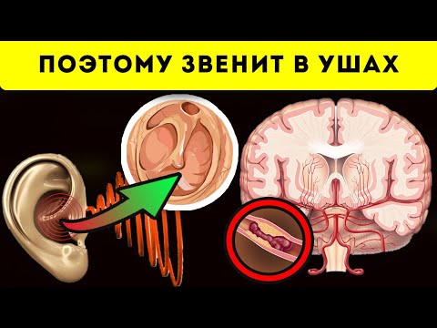 Видео: Шум в ушах пройдёт за 5 минут, если сделать 3 простых...