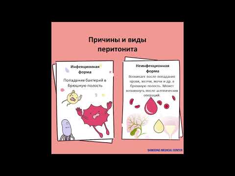 Видео: Полезная информация: Перитонит