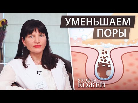 Видео: Как убрать расширенные поры. Избавляемся от жирной кожи