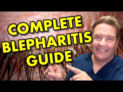 Видео: Все о типах, симптомах и лечении блефарита