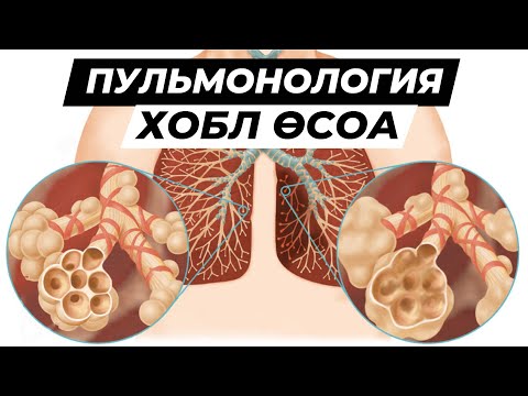 Видео: ХОБЛ / Этиолоия / Патогенез / Өкпенің созылмалы обструкциялық ауруы