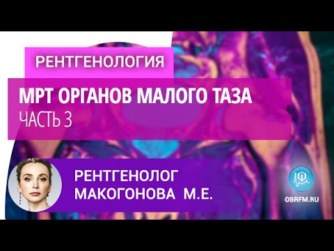 Видео: Рентгенолог Макогонова М.Е.: МРТ органов малого таза. Часть 3