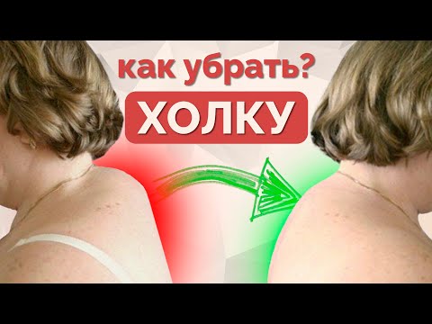 Видео: Как убрать вдовий горб? Упражнения от холки.