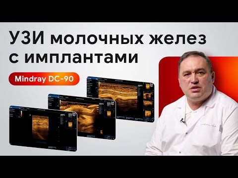 Видео: Мастер-класс по УЗИ молочных желез с имплантами