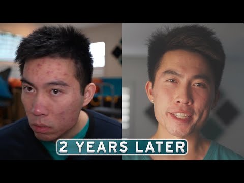 Видео: Аккутан не продержался долго... Вот что на самом деле сработало