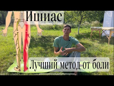 Видео: Ишиас, боль в ноге, ягодице, пояснице sciatica, leg pain, back pain