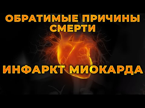 Видео: Инфаркт миокарда как обратимая причина клинической смерти #ПроСМП