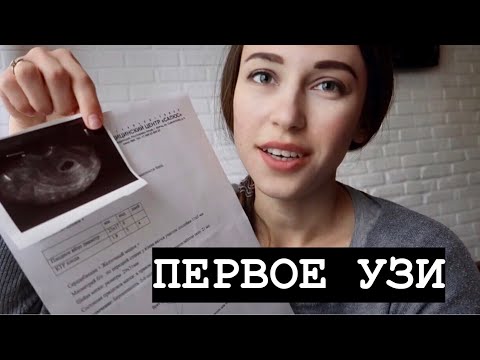 Видео: ПЕРВОЕ УЗИ🙌🏻ОТСЛОЙКА / ТОКСИКОЗ /
5- 7 НЕДЕЛЬ БЕРЕМЕННОСТИ🤍