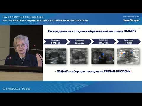 Видео: Классификации -RADS в практике врача ультразвуковой диагностики. Фисенко Е.П.