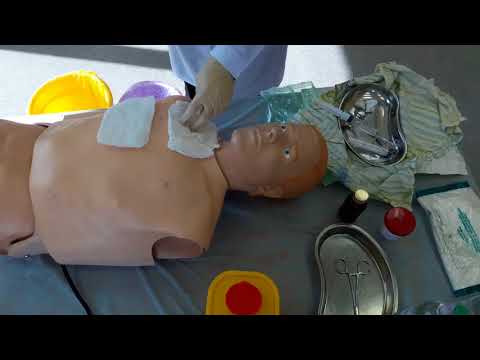 Видео: плевральная пункция