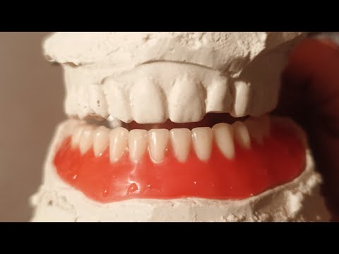 Видео: ПРОТЕЗДИ КАЛАЙ ДАЙЫНДАЙДЫ КОРЕМИЗ