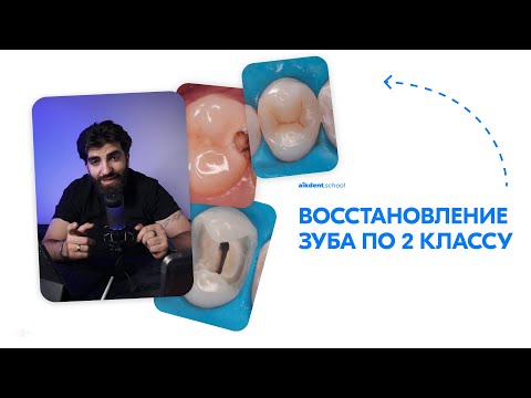 Видео: Восстановление зуба. 2 класс по Блэку. Погосян Айк. aikdent.school