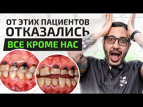 Видео: ТОП 5 самых сложных стоматологических случаев. Только мы решились лечить этих пациентов!