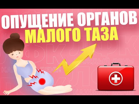 Видео: Упражнения при опущении органов малого таза | ЛФК