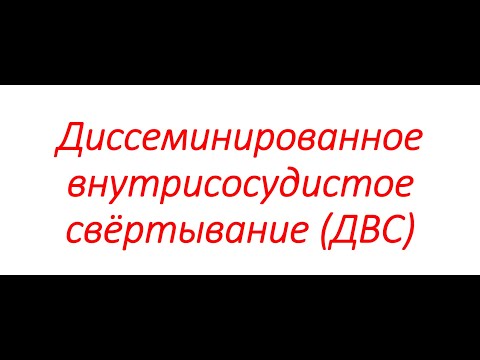 Видео: Диссеминированное внутрисосудистое свёртывание (ДВС)