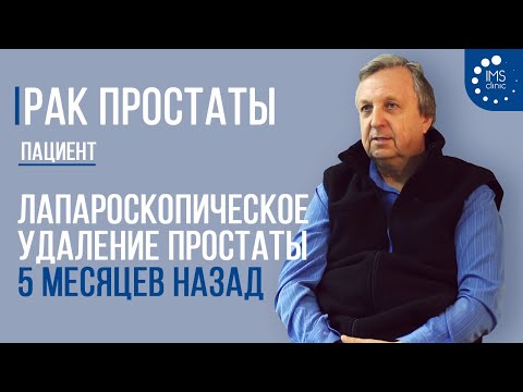 Видео: Рак простаты. Лапароскопическое удаление простаты 5 месяцев назад