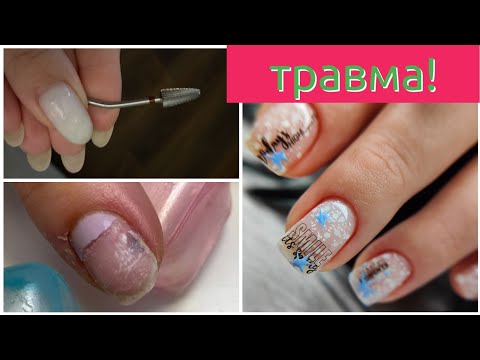 Видео: Фреза согнулась во время работы и повредила ноготь!