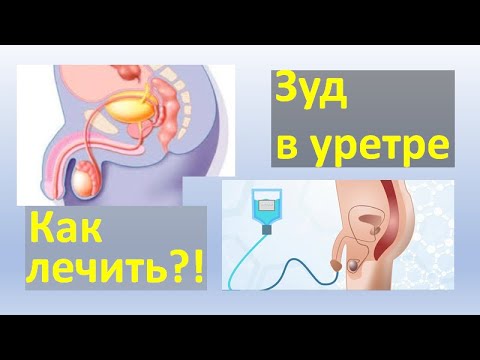 Видео: Зуд в уретре.  Как лечить?