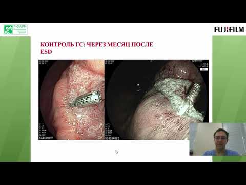 Видео: Клинические случаи. А. А. Митраков